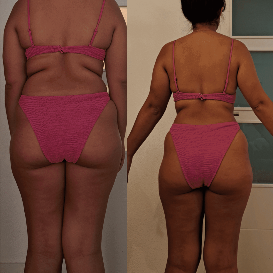 cambio físico de la paciente 2