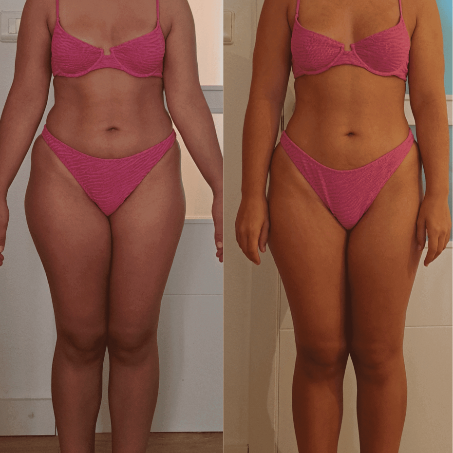 cambio físico de la paciente 1