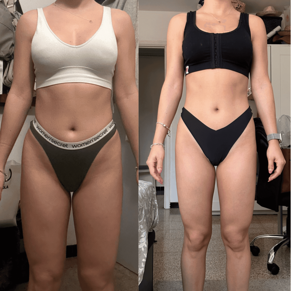 cambio físico de la paciente 3