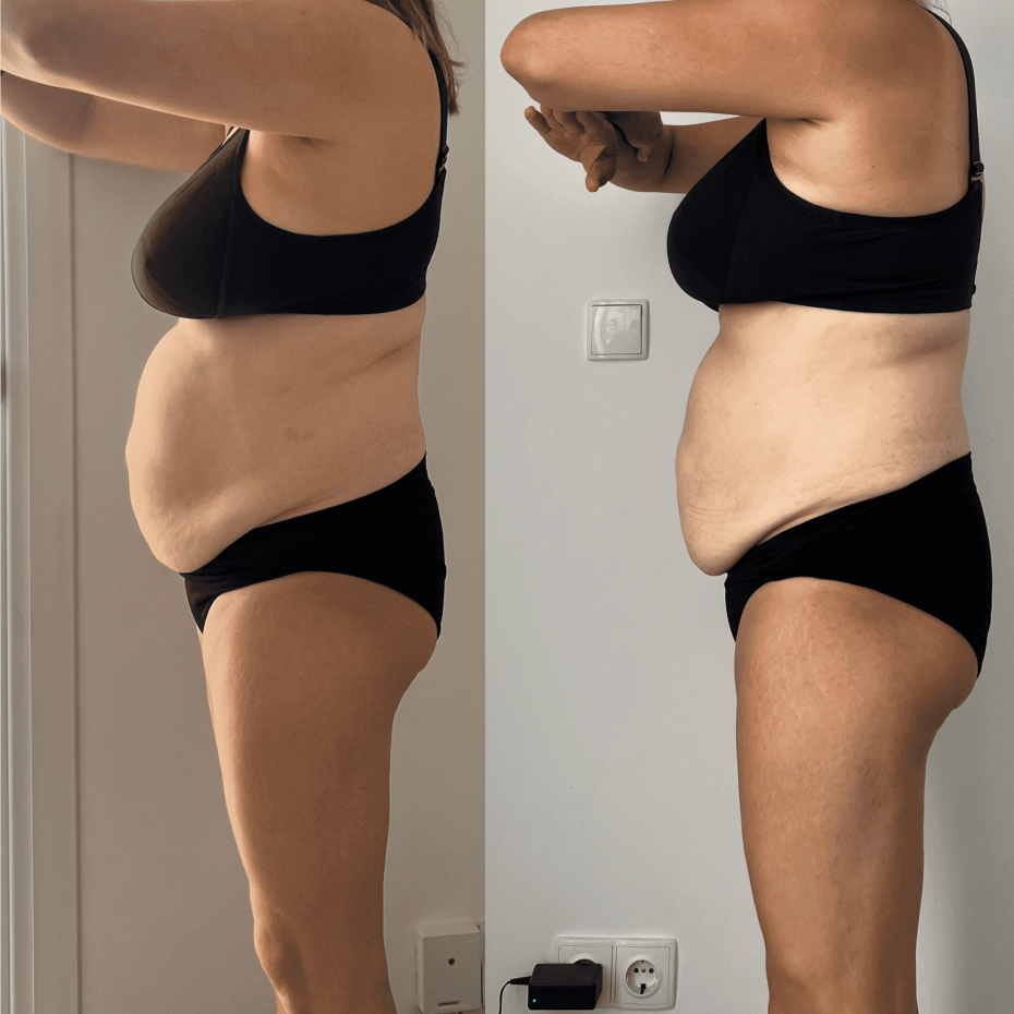 cambio físico de la paciente 4